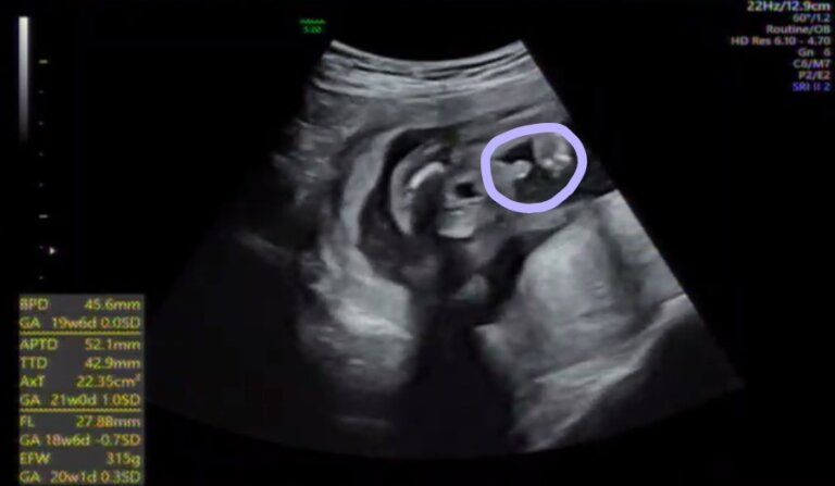 妊娠19週 5ヶ月 の記録 妊婦健診で何する 性別はわかった